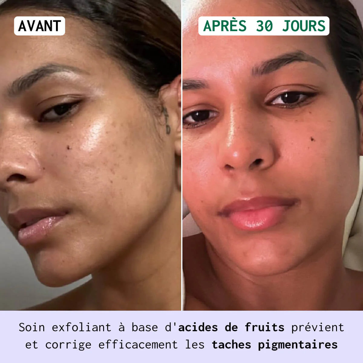 Sérum Eclat Anti-Taches aux AHA Nubiance 30ml